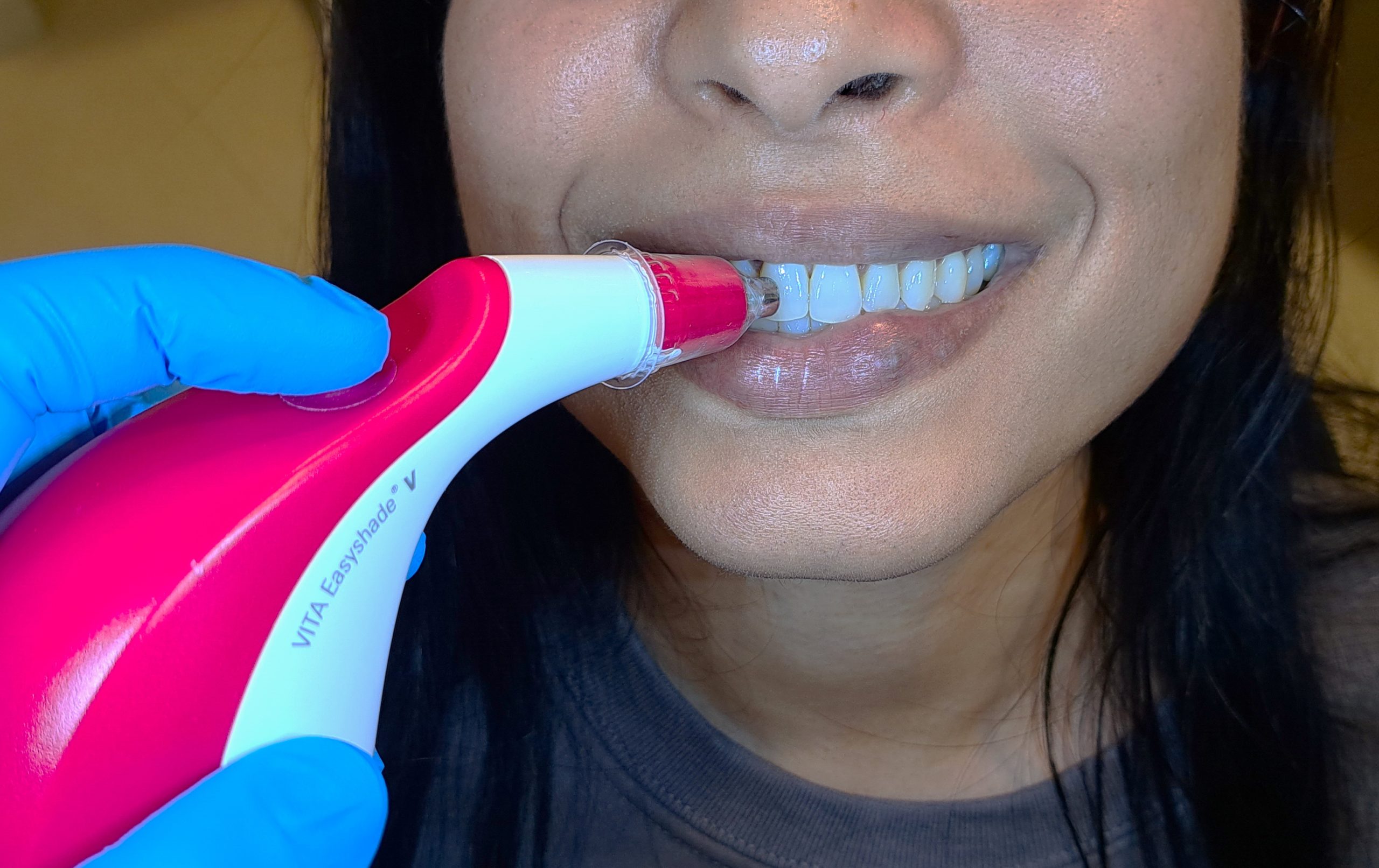 Foto de un cómo se mide el tono de blancura de los dientes con un espectrofotómetro