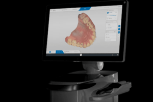 Imagen en 3D que permite hacer el escáner intraoral de última tecnología